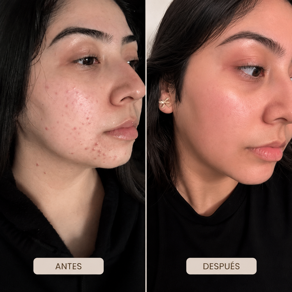 ANUA Sérum Corrector de Manchas Niacinamida 10% + Ácido Tranexámico 4%