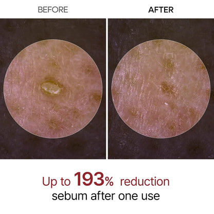 Ampolla Exfoliante Brillo Diaria