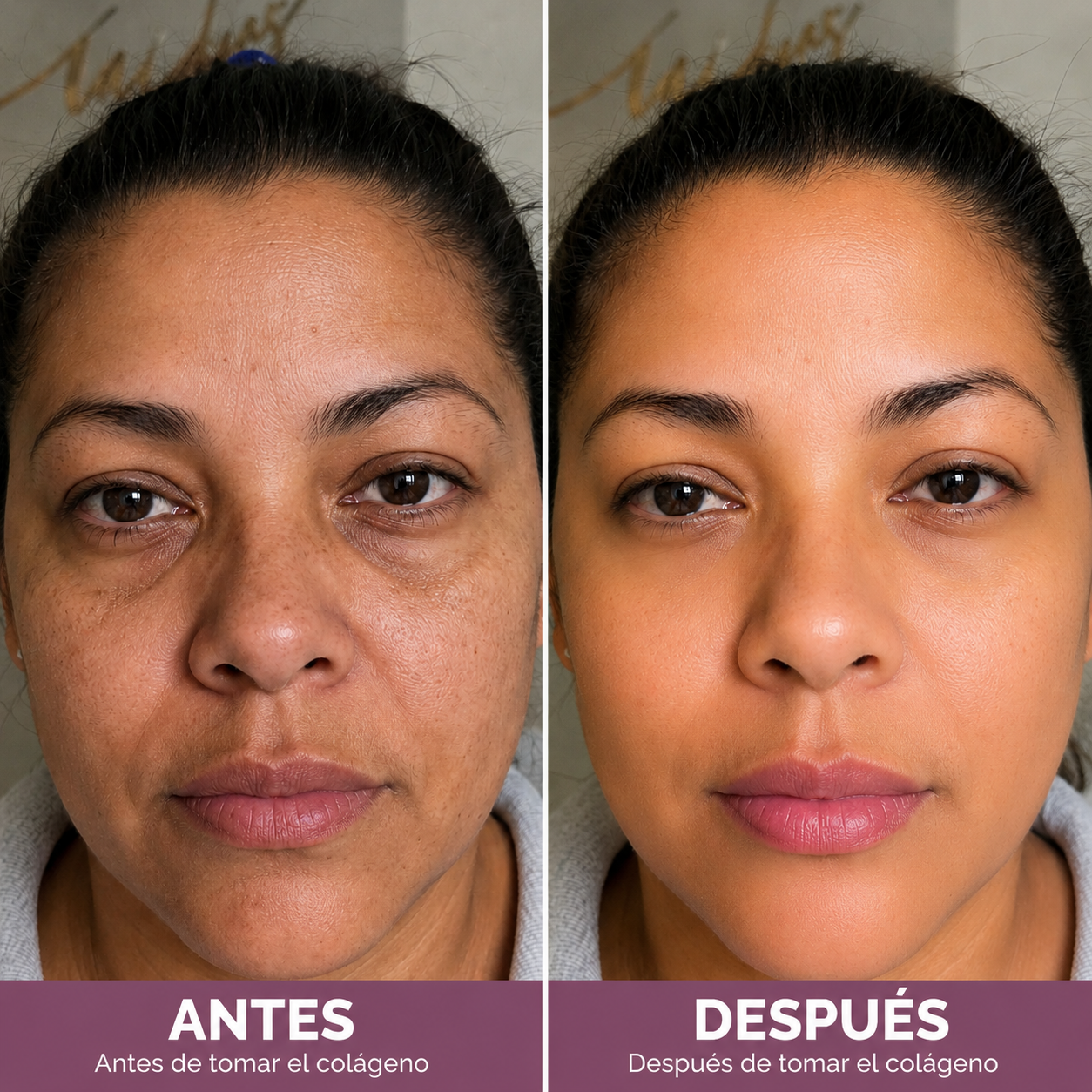 Colágeno Hidrolizado 5 en 1 - Piel Firme, Cabello Fuerte y Articulaciones Sanas