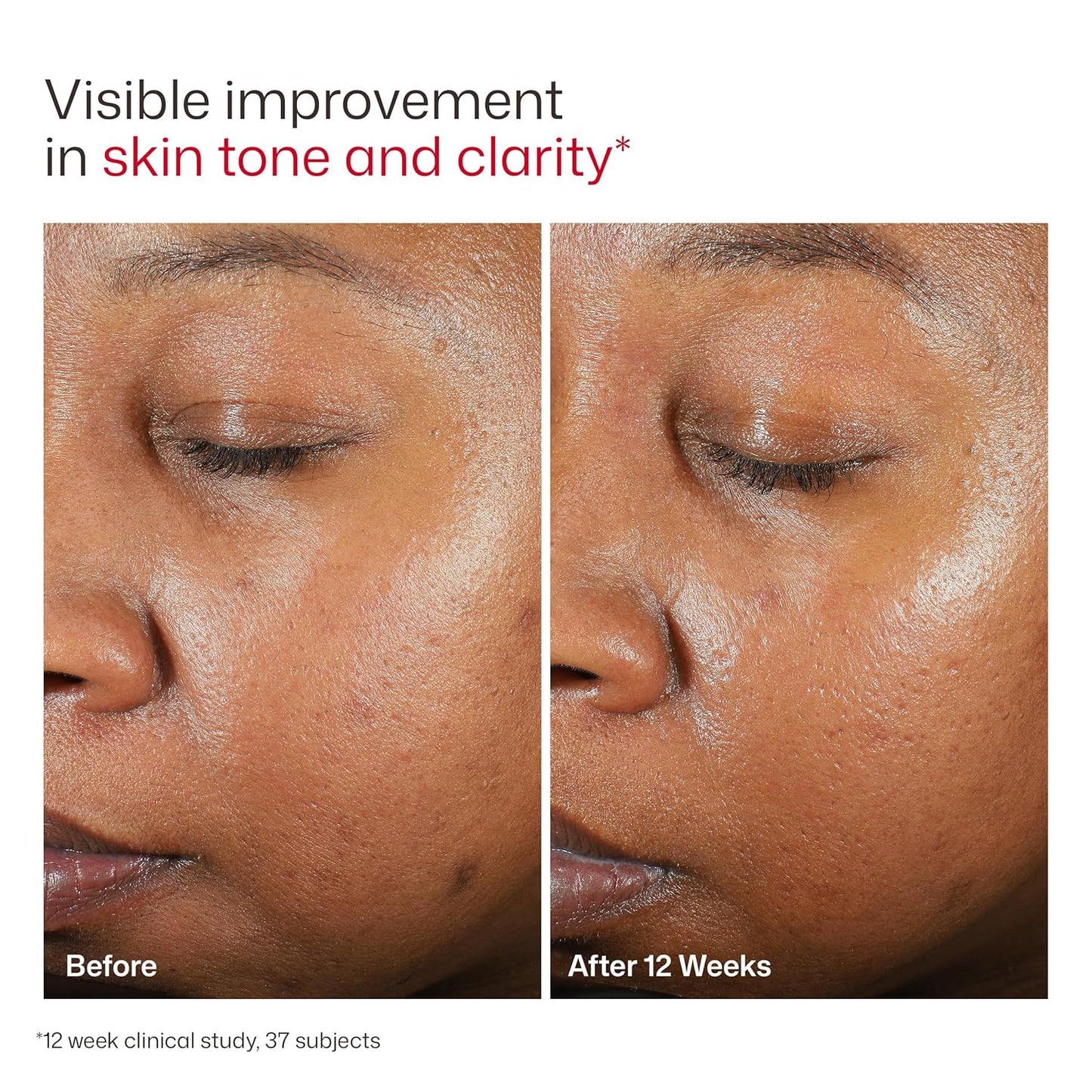 EltaMD  SPF 46- Protector Solar facial invisible.