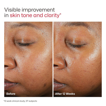 EltaMD  SPF 46- Protector Solar facial invisible.